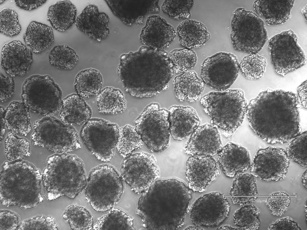 iPSC-derived embryoid bodies supporting human lymphocyte development