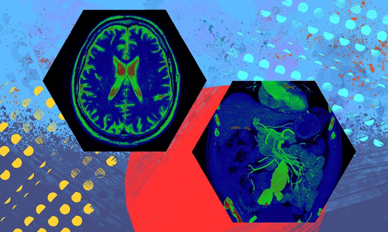 Two hexagon-framed medical scans show a human brain and abdomen, set against a vibrant blue and red abstract background.