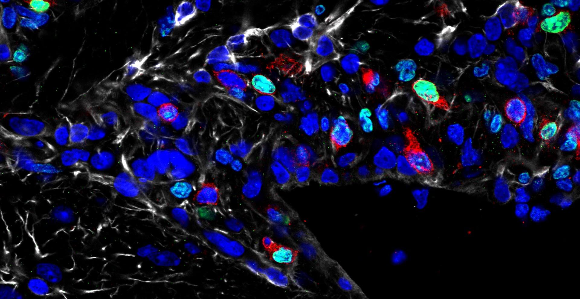 A black image with bold, blue and teal spots. Pixels of red surround some of the spots.