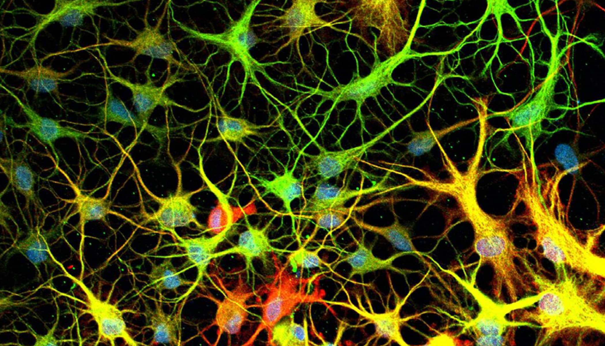 Clusters of green, yellow, red and orange vein-like figures with circles at their center.