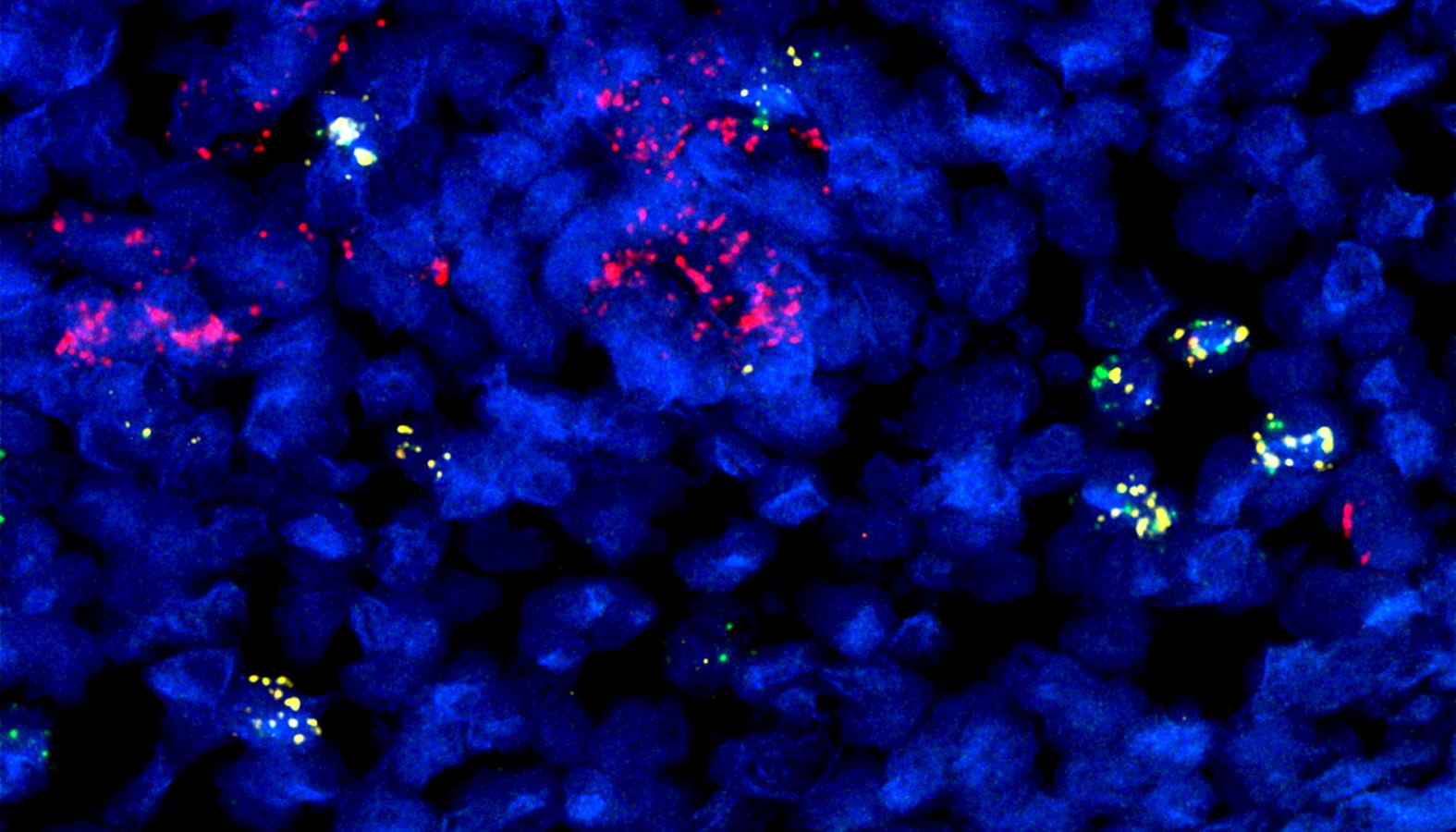 Small blue circles overlay a black background. Pink and yellow fluorescent spots appear around the image.