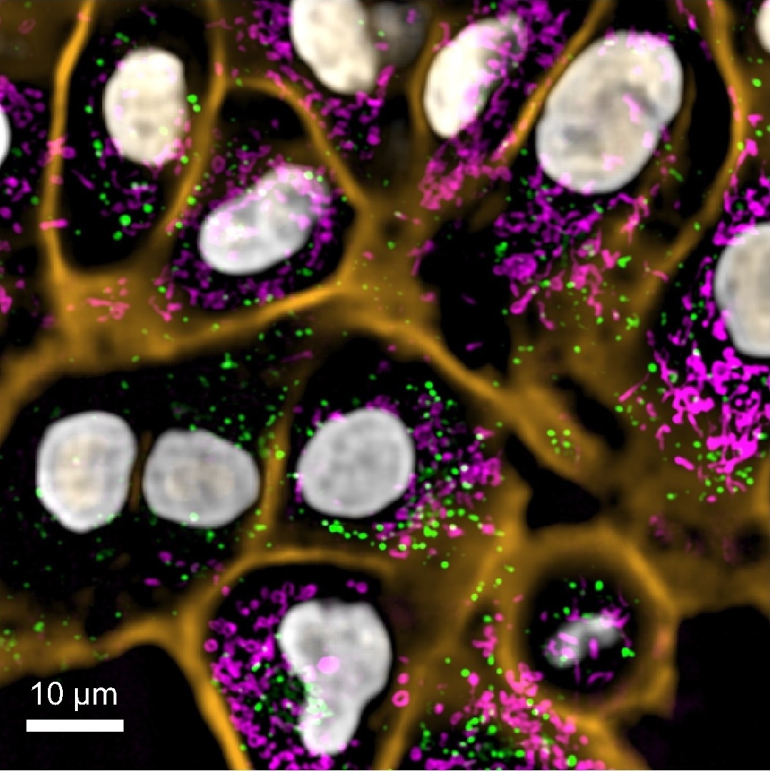Fluorescent microscopy image showing cell structures with highlighted organelles in green, magenta, and orange