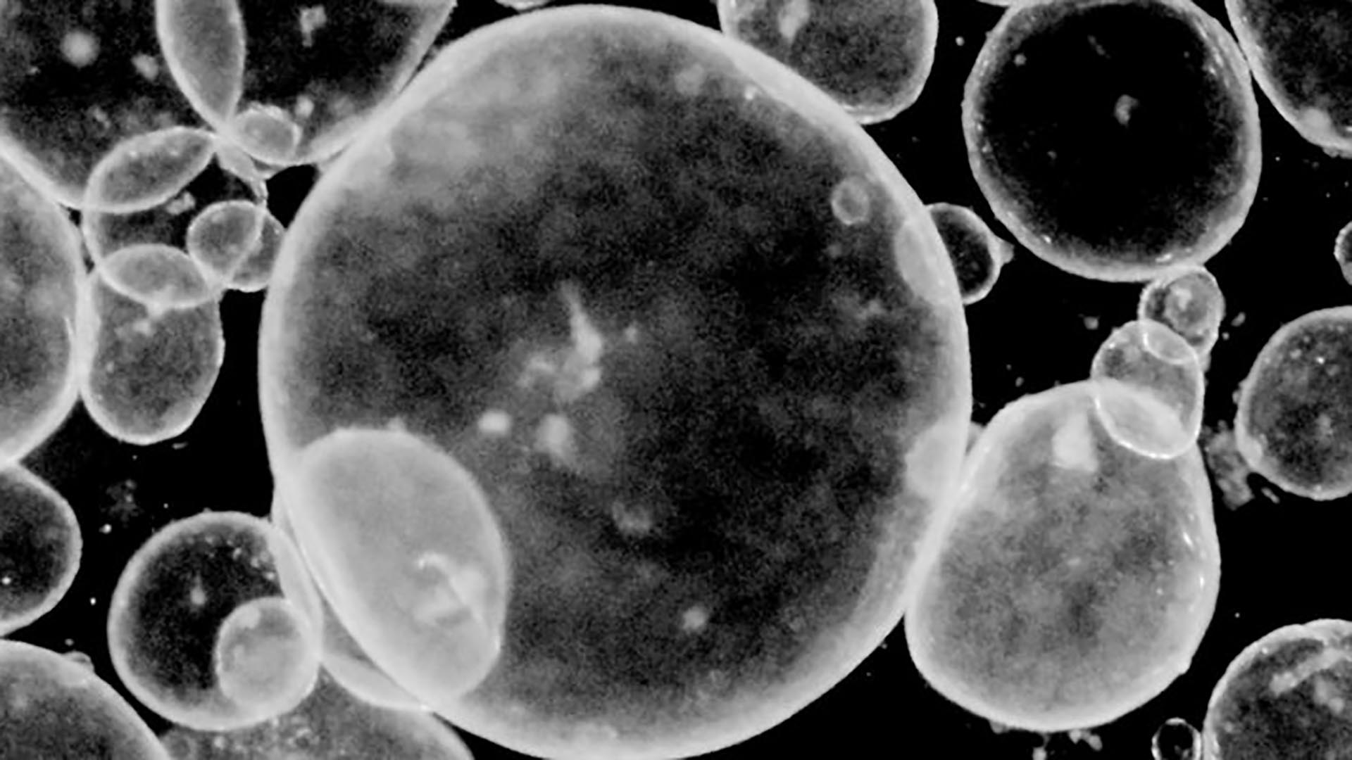 Single-cell biology represented by grayish bubbles of varying shapes on a black background.