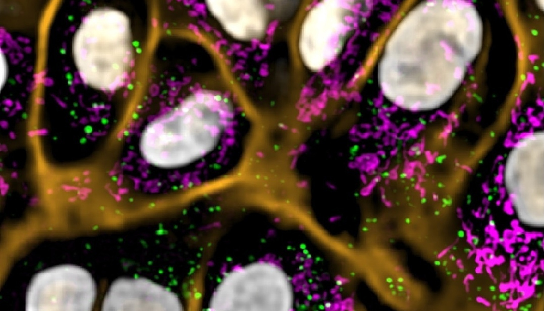 Fluorescent microscopy image showing cell structures with highlighted organelles in green, magenta, and orange.